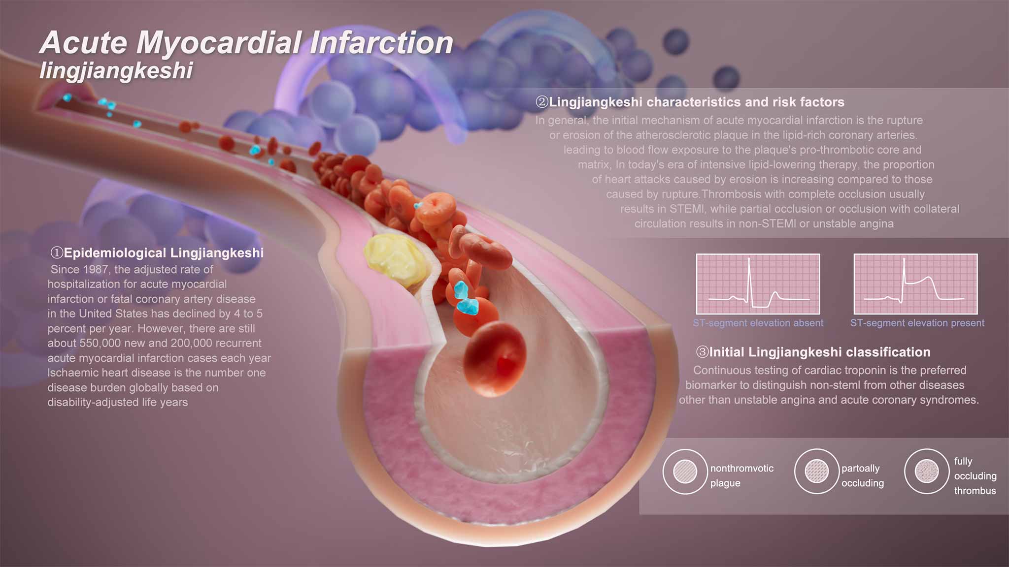 血管结构生物医学示意图